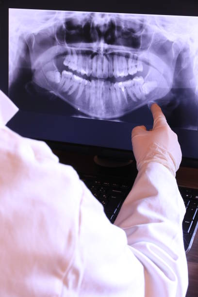 Best Emergency Broken Tooth Repair in Saginaw, TX